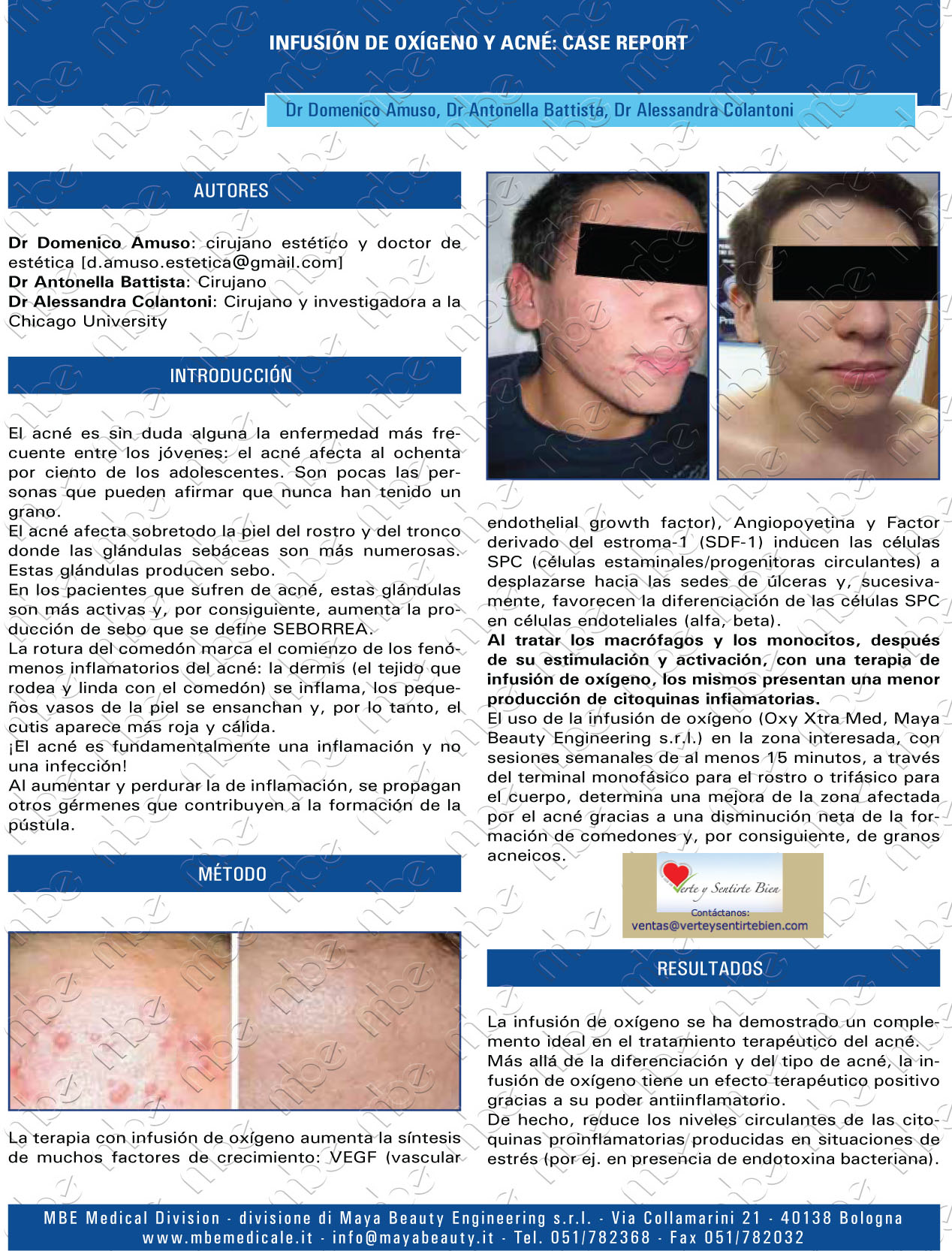 como tratar la soriasis